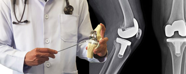 Chirurgien orthopédiste